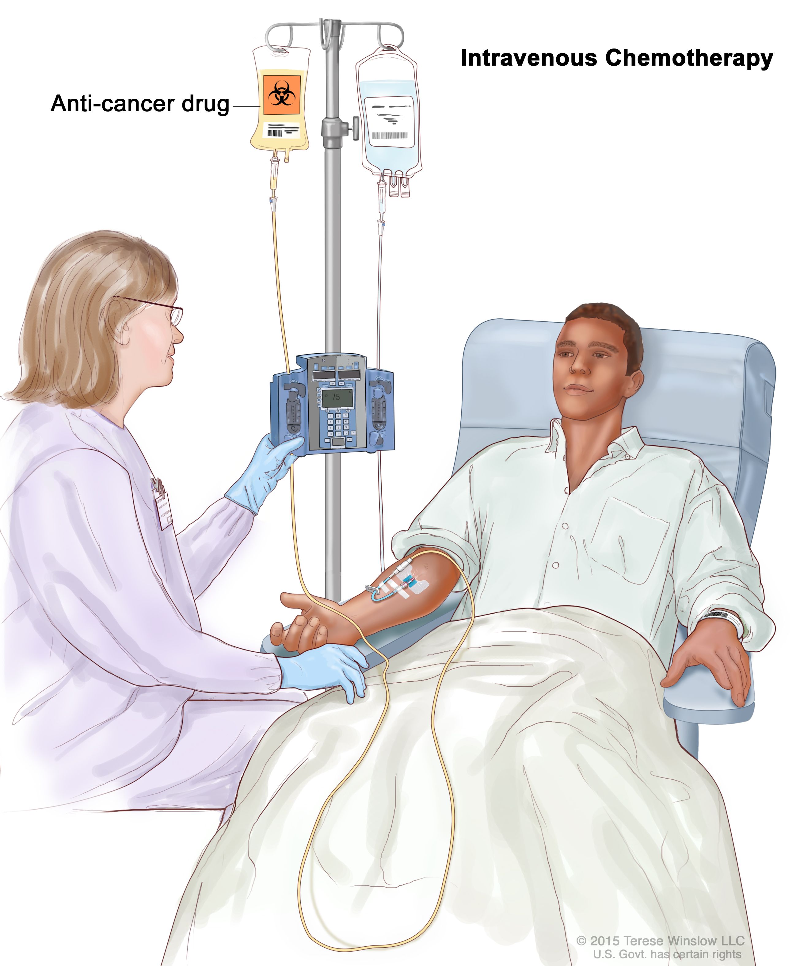 Chemotherapy