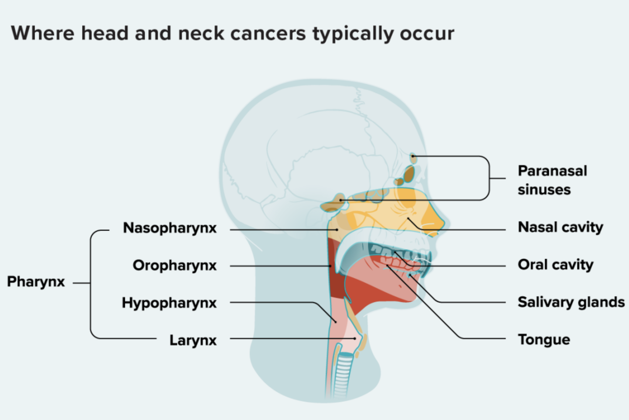 Head and Neck Cancers