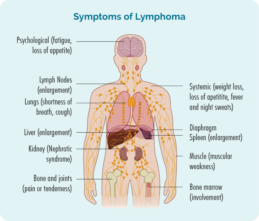 Lymphomas