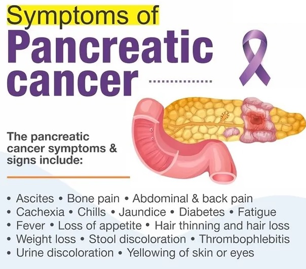 signs of Pancreatic cancer