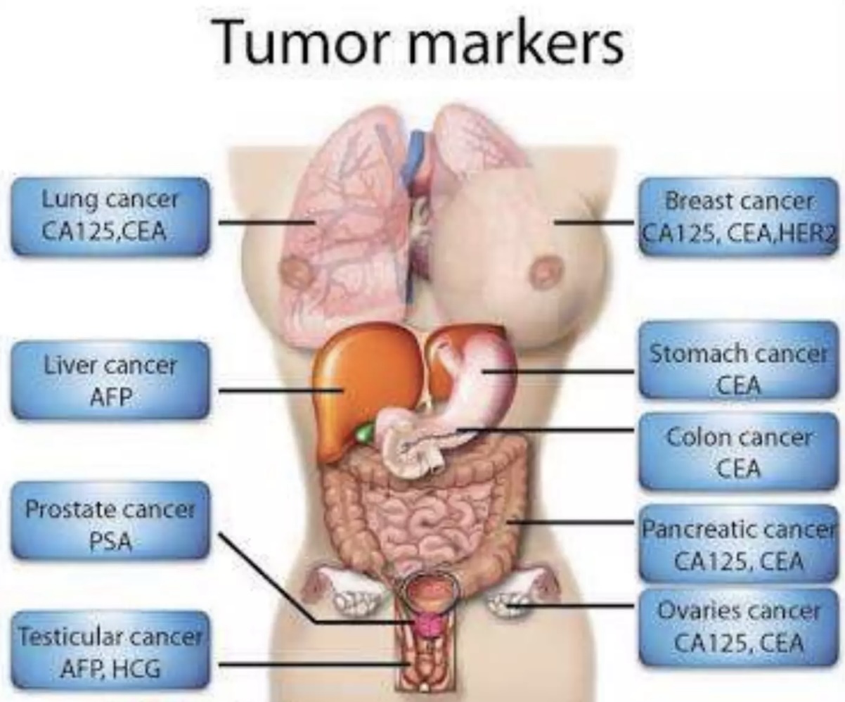 Tumor Markers